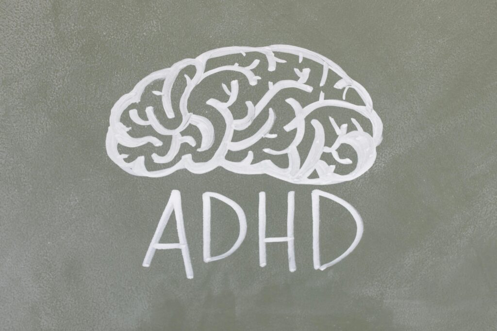 An ADHD brain
