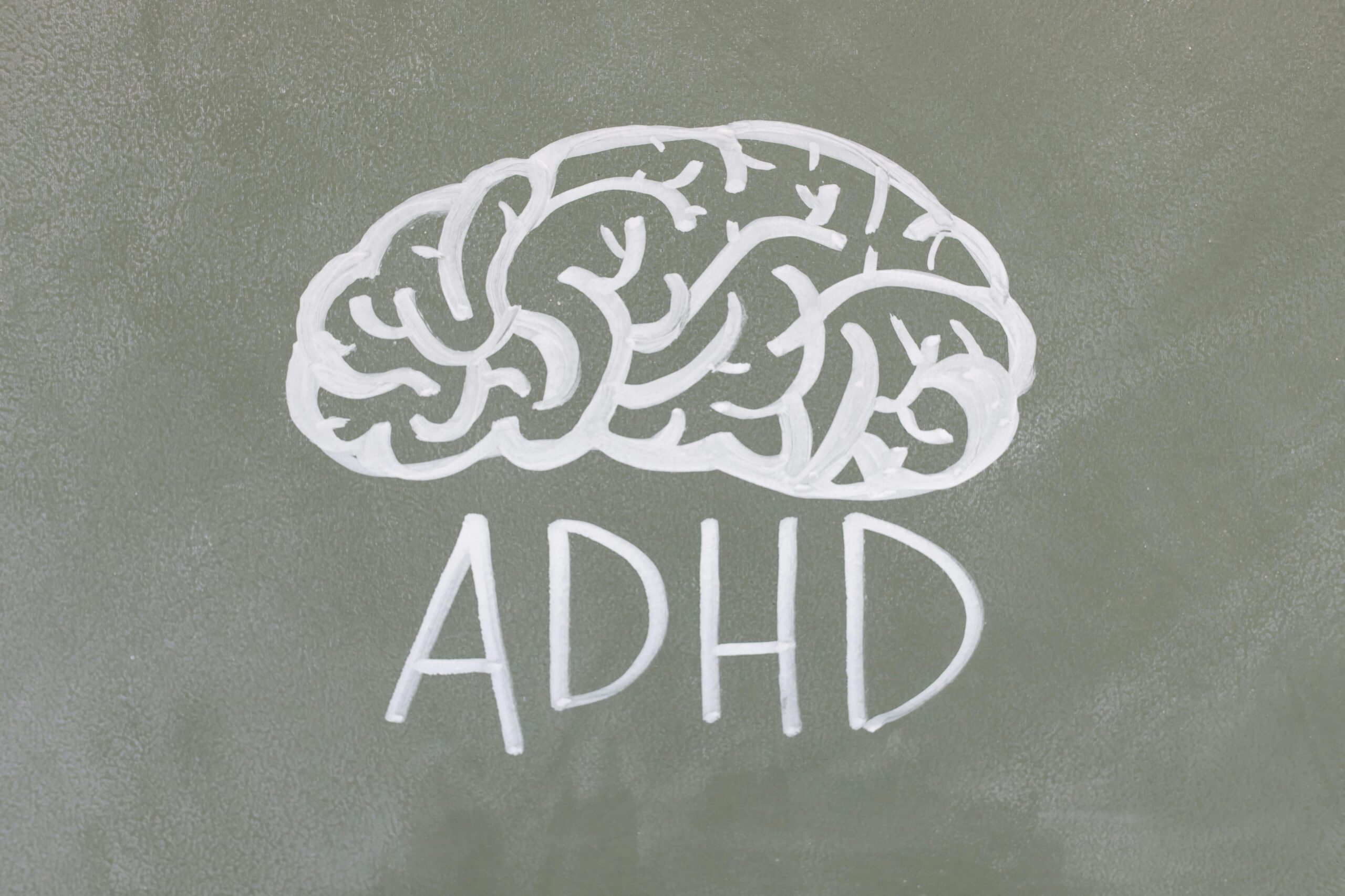 An ADHD brain